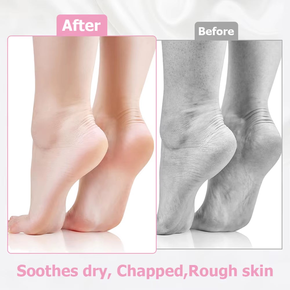 2 Pack Moisturizing Silicone Gel Socks for Dry Cracked Feet Nourishing Skin Lubricating Foot Care Massage Socks Manicure Tools